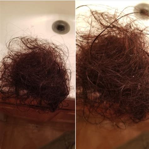 But, it is not overreacting to worry whether the hair loss is more than enough. How To Help Clients With COVID-19 Hair Loss ...