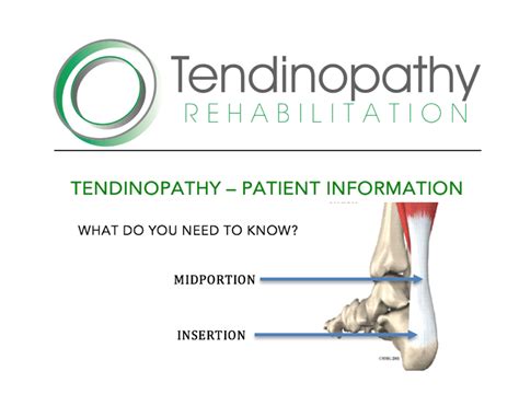 9 Tendinopathy Truths That You Must Know Version 2 Truth Need To