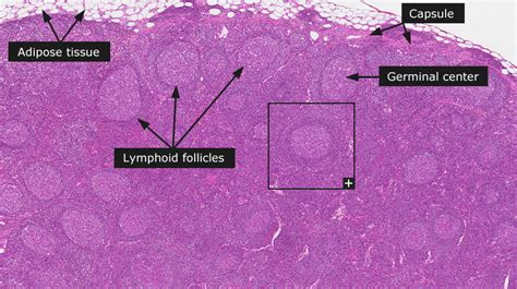 Lymph Nodes 101