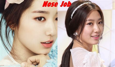 Park Shin Hye Plastic Surgery Nose Job Before And After Photos