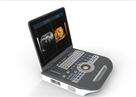 Medical Ultrasound Machine Portable Ultrasound Scanner 4d Ultrasound