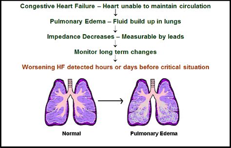 From Heart Failure Pulmonary Edema