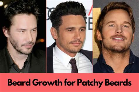 How To Grow A Thicker Beard 5 Proven Tips Bald And Beards