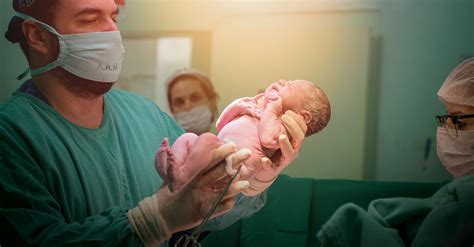 Free Stock Photo Of Baby Babyborn Born