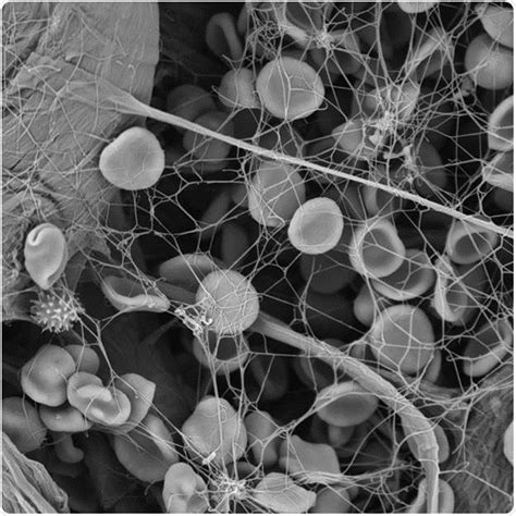 Scanning Electron Microscope Of White Blood Cell Foto