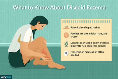 Causes And Treatments For Discoid Eczema Patches