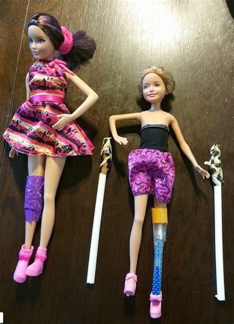 Love That Max Dolls With Disability The New Line People Are Loving