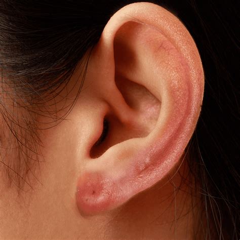 Infected Ear Piercing Symptoms Causes And Treatment