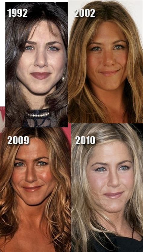 Celebrity Nose Jobs Jennifer Aniston Nose Job Before And After Plastic