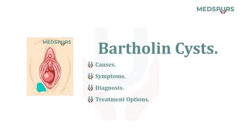 Bartholin Cysts Causes Treatment And Questions In Medspurs