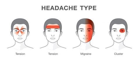 Headache Or Migraine How To Tell The Difference Jandsvision
