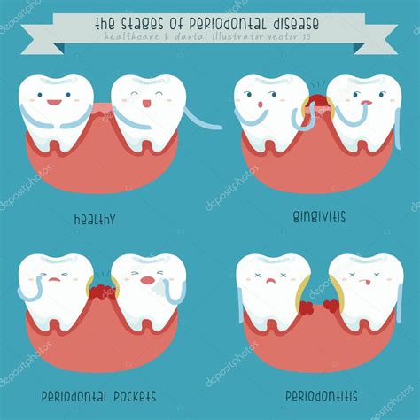 The Stages Of Periodontal Disease — Stock Vector © Kninwong 50946333