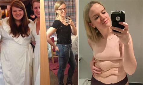 former eating disorder sufferer shares pictures of stomach daily mail online