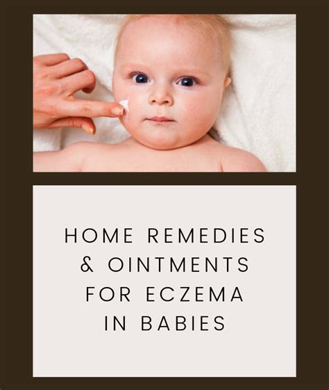 Home Remedies And Ointments For Eczema In Babies Baby Eczema Home
