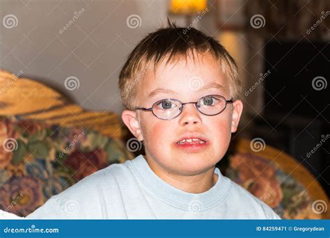 Portrait Of Young Boy With Downs Syndrome Stock Image Image Of Young