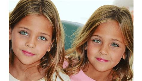 These Twins Were Named “most Beautiful In The World” Wait Till You See