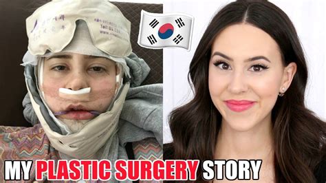 I Got Plastic Surgery In Korea Double Jaw Surgery Experience