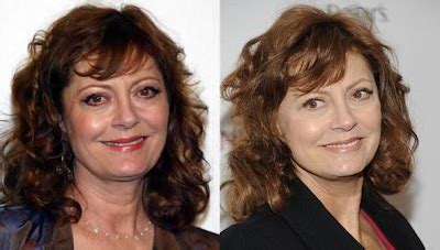 Free General Fashion Susan Sarandon Before And After Plastic Surgery