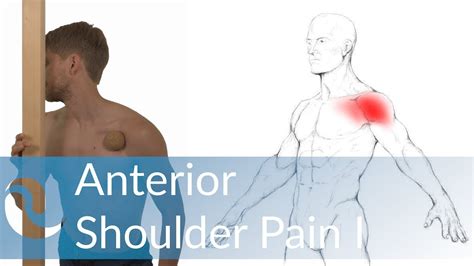 Shoulder pain is a common problem, affecting around thirty percent of people. Anterior Shoulder Pain - Self Relief / Part I - YouTube