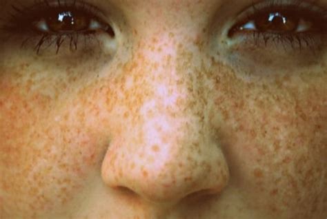 freckles are the best freckles red hair freckles freckle face