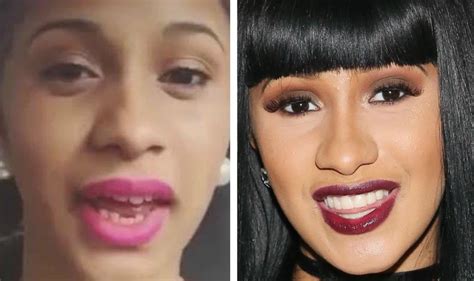 Rapper Cardi B Didnt Always Have That Smile — See Before And After