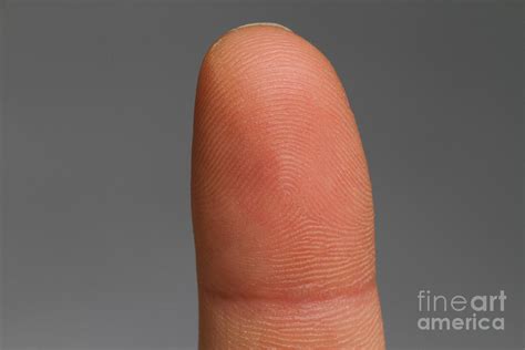 Fingertip Showing Fingerprint Ridges Photograph By Photo Researchers Inc