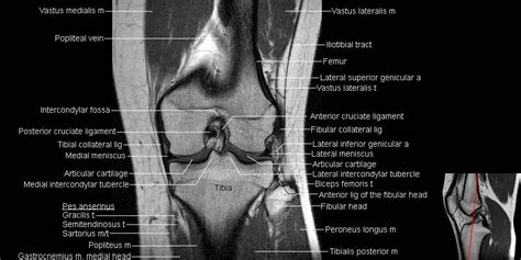 Knee Joint Mri Anatomy