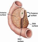 What Is Sma In Medical Terms Photos