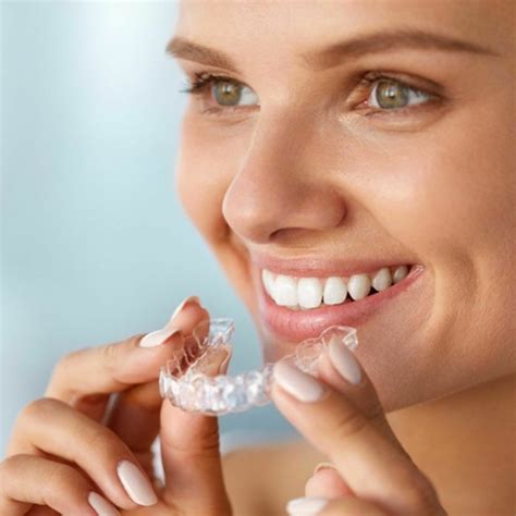 stream episode abba dental amazing things you didn t know about invisalign by abba dental