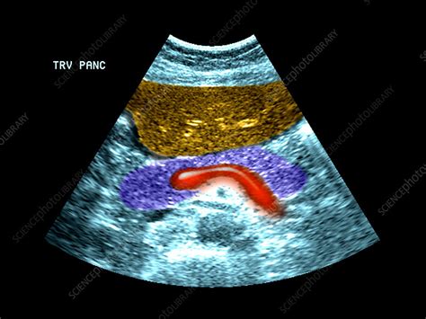 Epigastric Region Stock Image P5000086 Science Photo Library