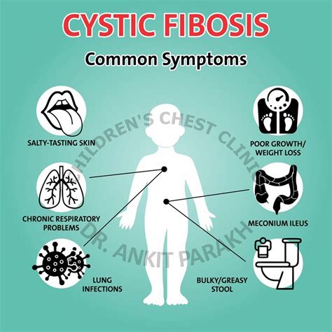 Cystic Fibrosis Dr Ankit Parakh