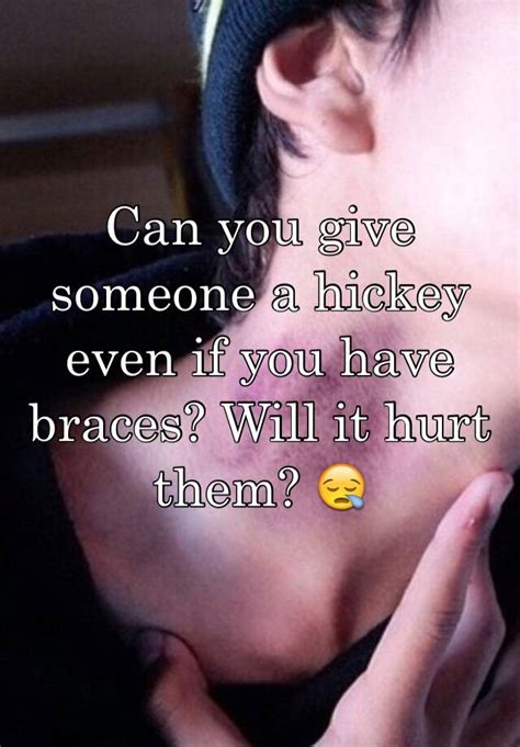 Check spelling or type a new query. Can you give someone a hickey even if you have braces ...
