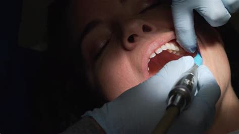 Scenes From A Dentist Office Visit 24 Stock Footage Videohive