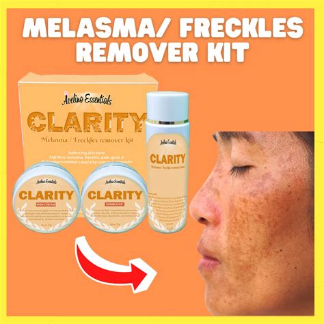 Clarity Melasma Treatment Set Melasma And Dark Spot Remover Melasma