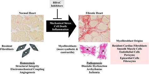 Targeting Cardiac Fibroblasts To Treat Fibrosis Of The Heart Focus On