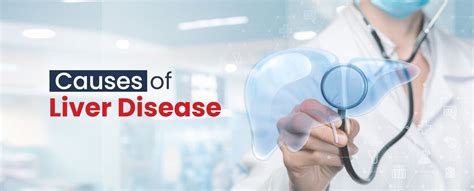 Causes Of Liver Disease Medigence