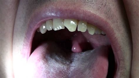 Ridiculously Long Uvula High Def Youtube