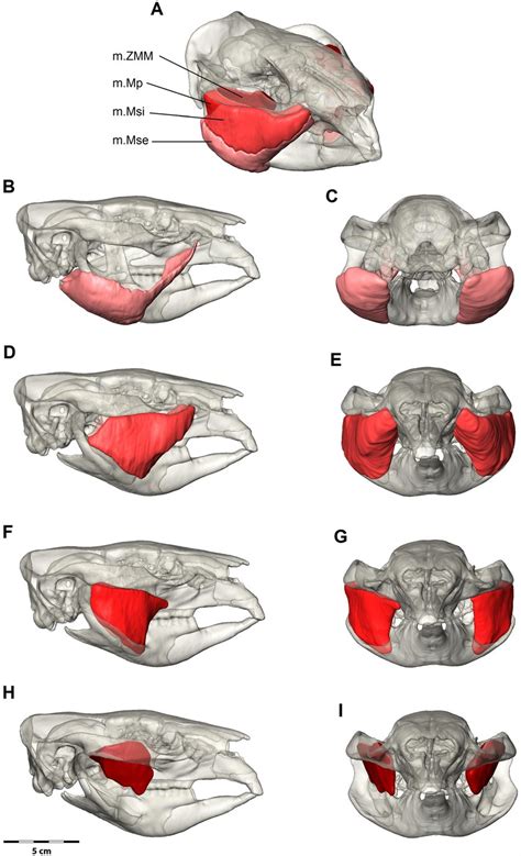 Digital Dissection Of The Masseter Muscle Group A Oblique View With