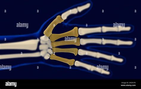 Huesos Metacarpianos De La Mano Anatomía Del Concepto Médico 3d