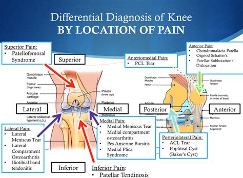 Diagnostic Imaging In Acute Ankle And Knee Injuries World Of Health