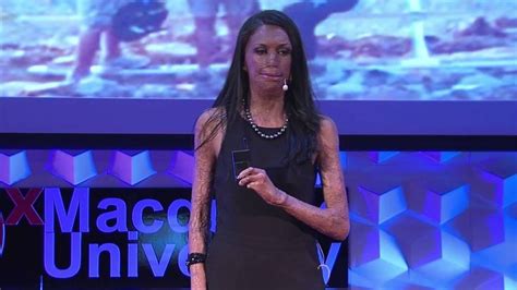 Unmask Your Potential Turia Pitt Tedxmacquarieuniversity Youtube Ted Talks Tedx Banksters