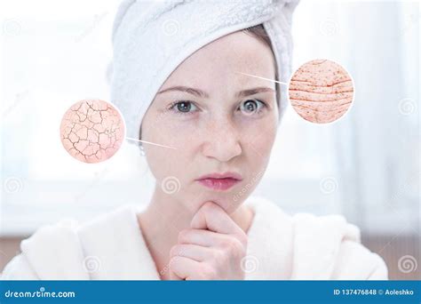 Young Woman Looking At Dry Skin With Cracks And With Wrinkles Circles
