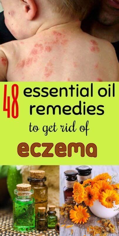 Essential Oil Remedies For Eczema Oils For Eczema Essential Oils For