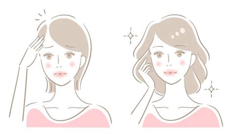 Thinning Hair Women Illustrations Royalty Free Vector Graphics And Clip
