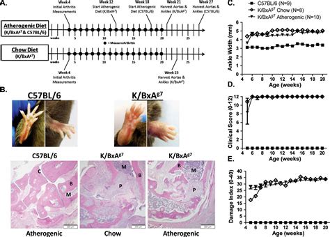 A Novel Mouse Model That Develops Spontaneous Arthritis And Is