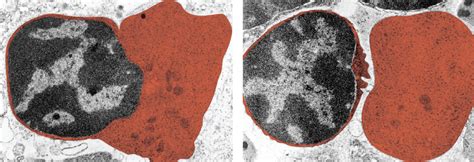 This Set Of Micrographs Shows A Red Blood Cell Extruding