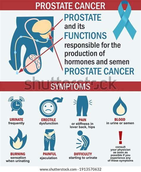 Infographics Prostate Cancer Illustration Prostate Cancer Stock Vector Royalty Free 1913570632