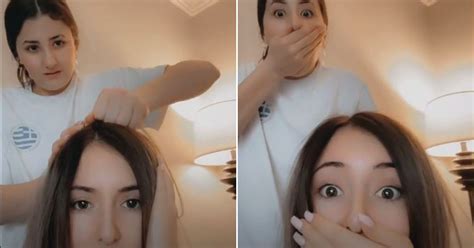 Scalp Popping Is The Latest Tiktok Trend But Experts Warn Against