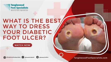 What Is The Best Way To Dress Your Diabetic Foot Ulcer Youtube