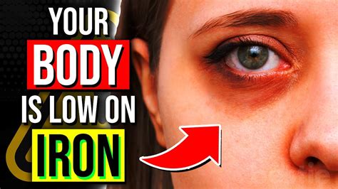Warning Signs Of An Iron Deficiency Your Body Is Trying To Tell You